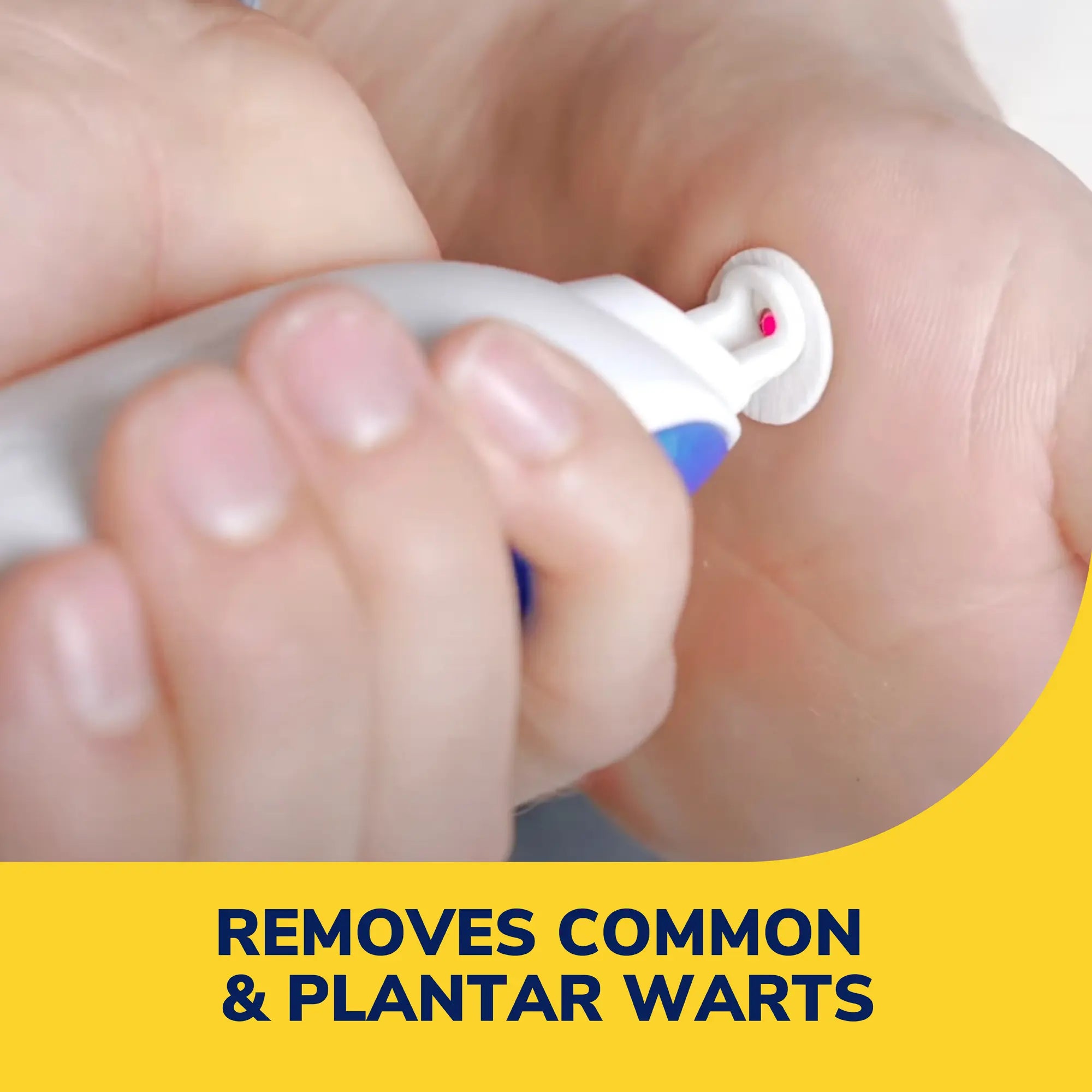 Freeze Away Max? Wart Remover - Image 2