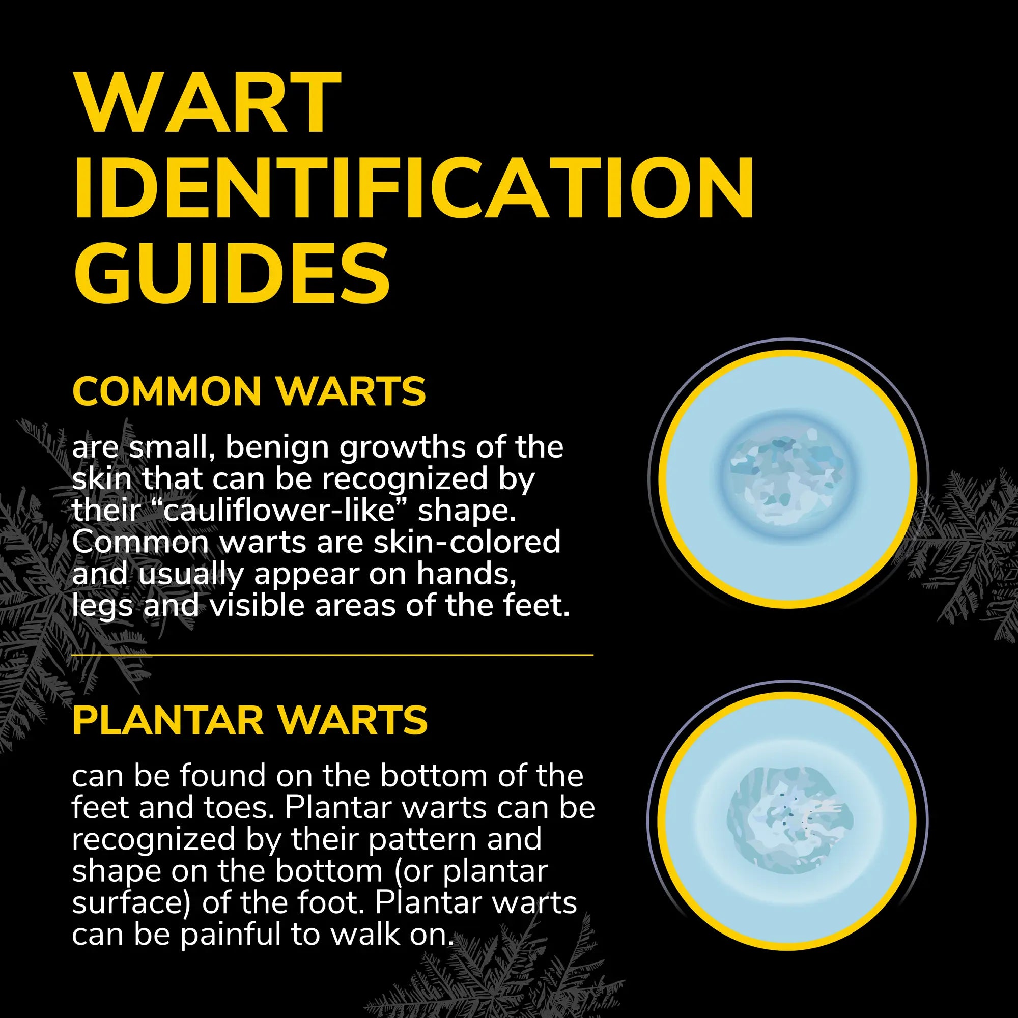 Freeze Away Max? Wart Remover - Image 5