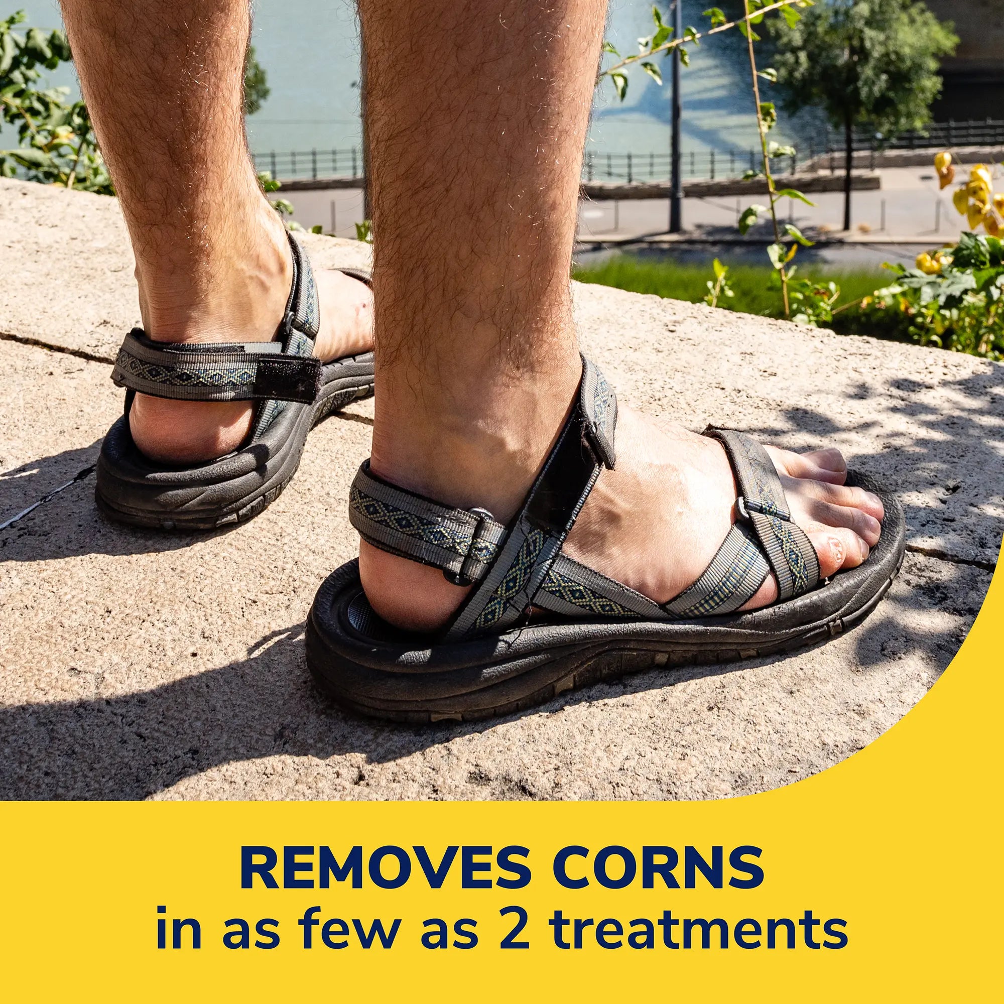Corn Removers Seal & Heal Bandage with Hydrogel Technology - Image 7