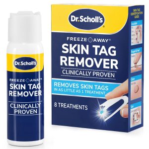 Freeze Away? Skin Tag Remover