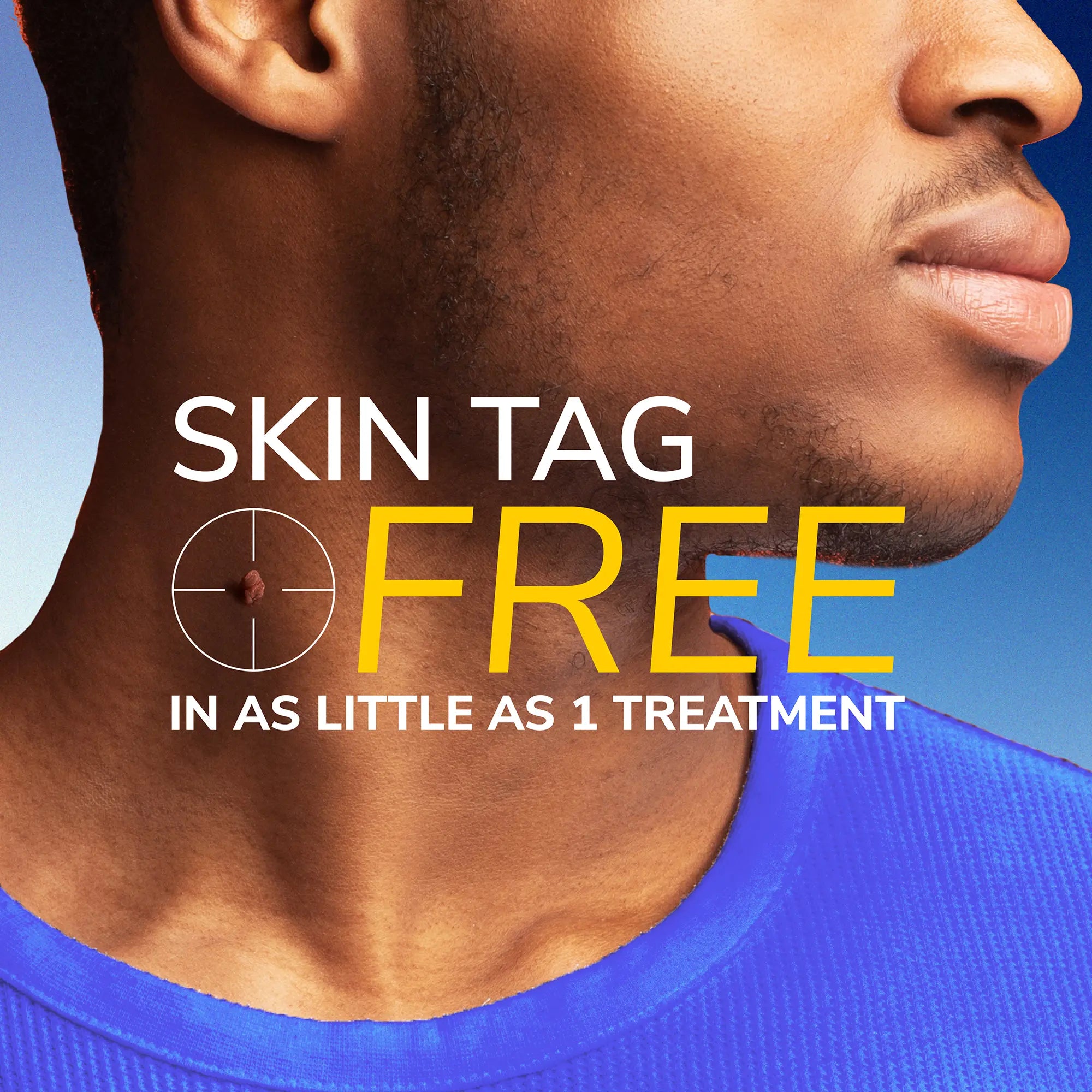 Freeze Away? Skin Tag Remover - Image 3