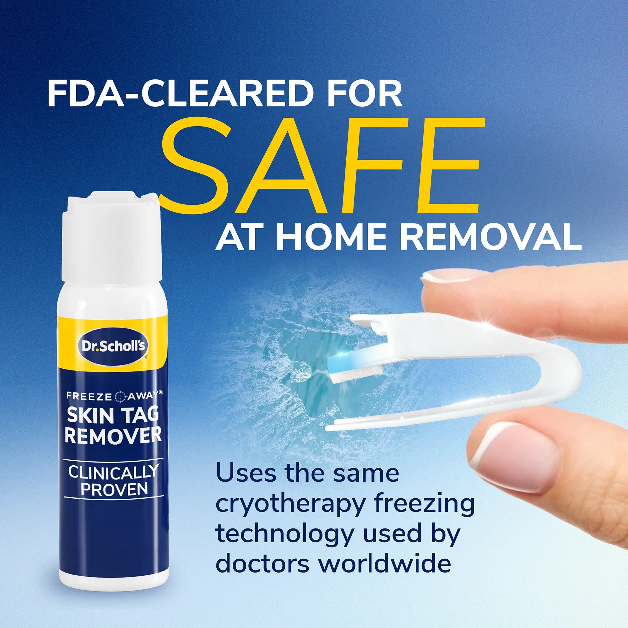 Freeze Away? Skin Tag Remover - Image 4