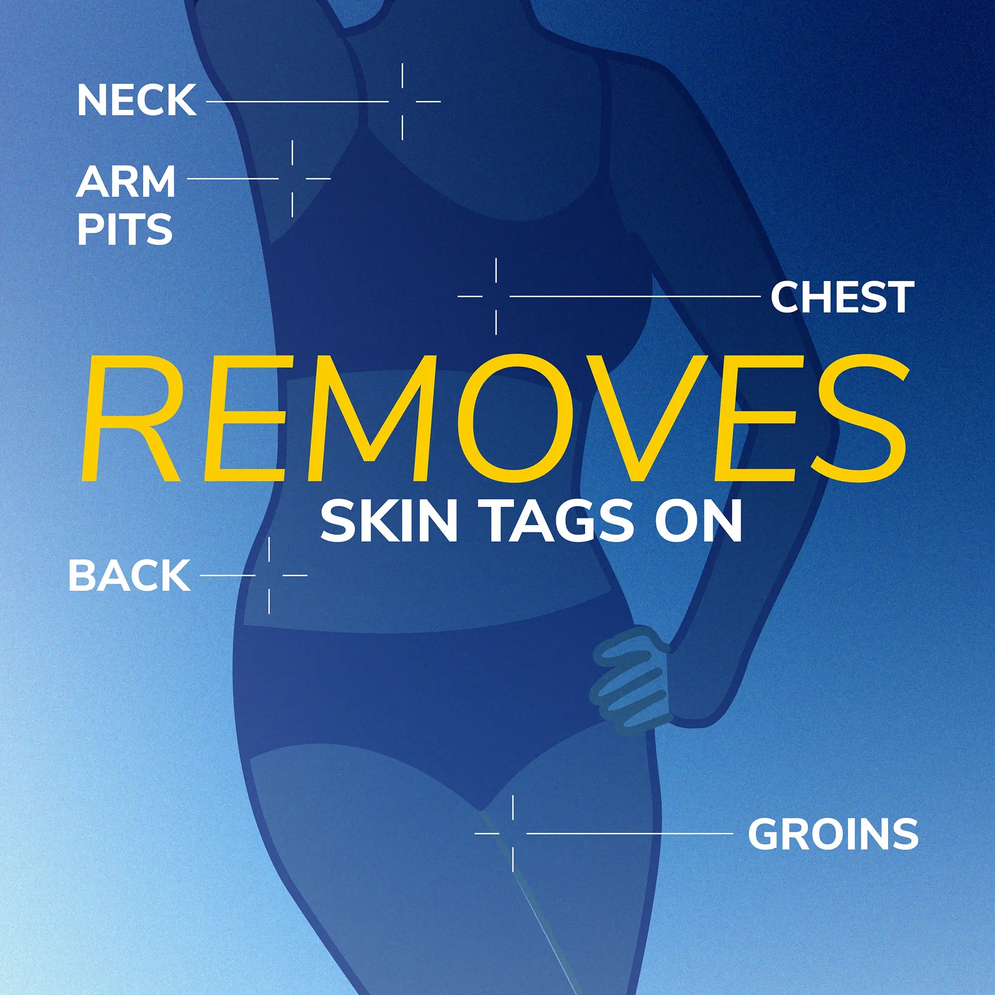 Freeze Away? Skin Tag Remover - Image 7
