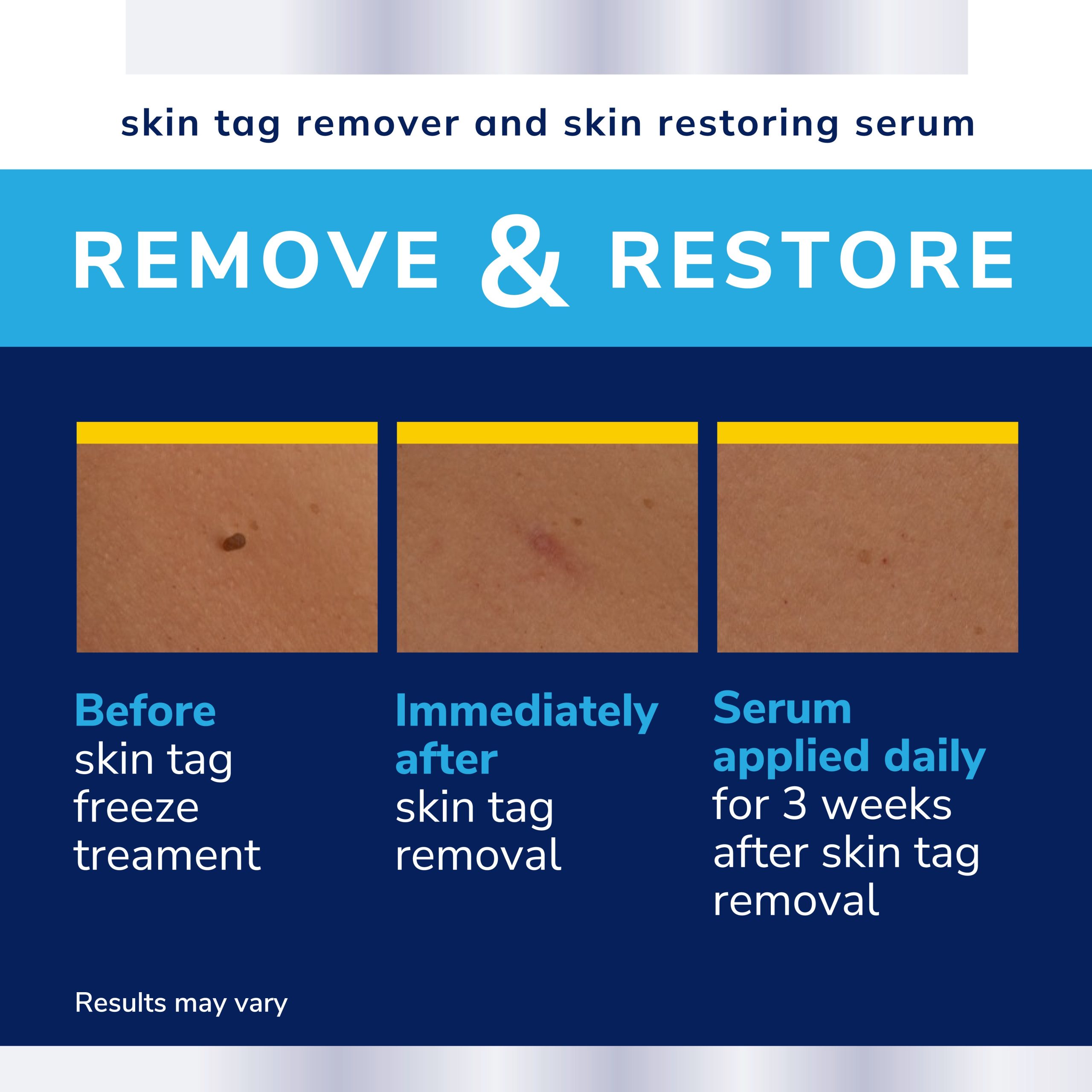 Skin Tag Complete Care - Image 7