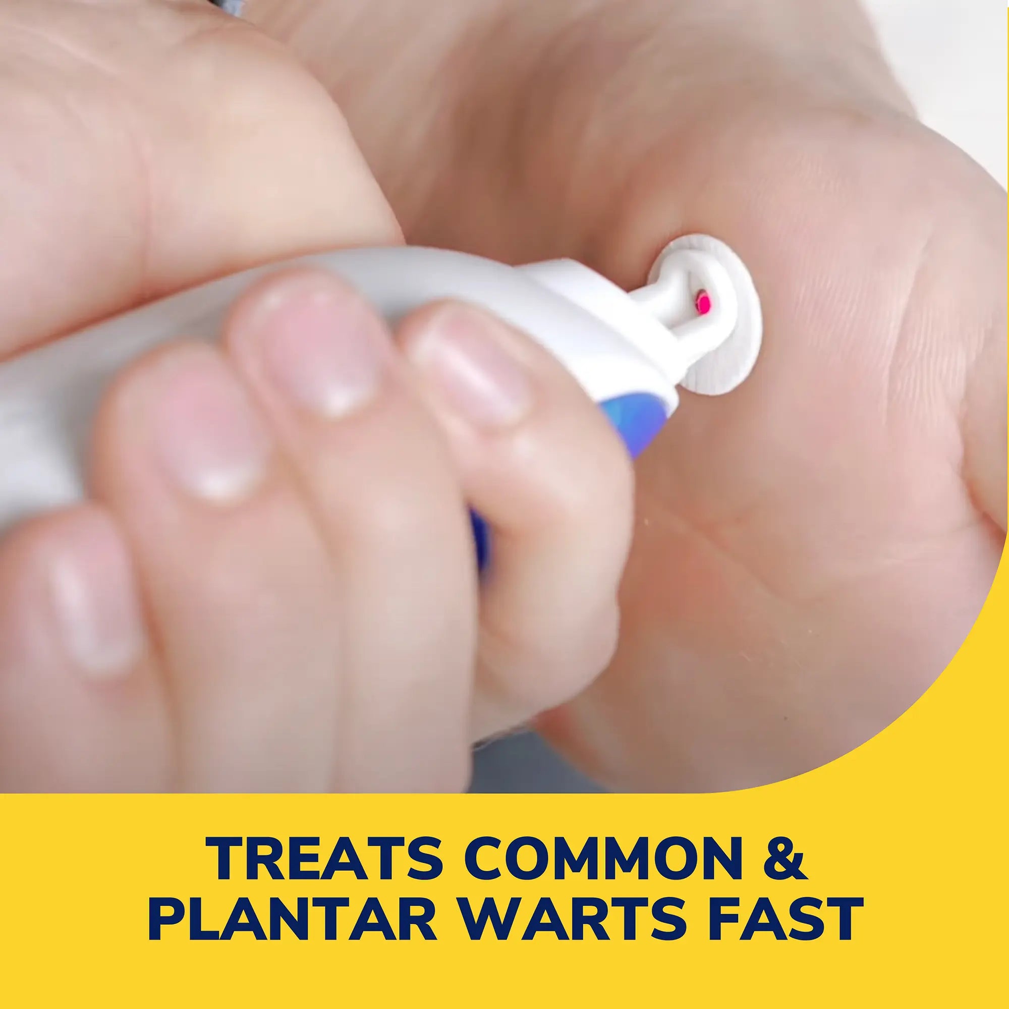 Freeze Away Max? Wart Remover (2 Pack) - Image 3