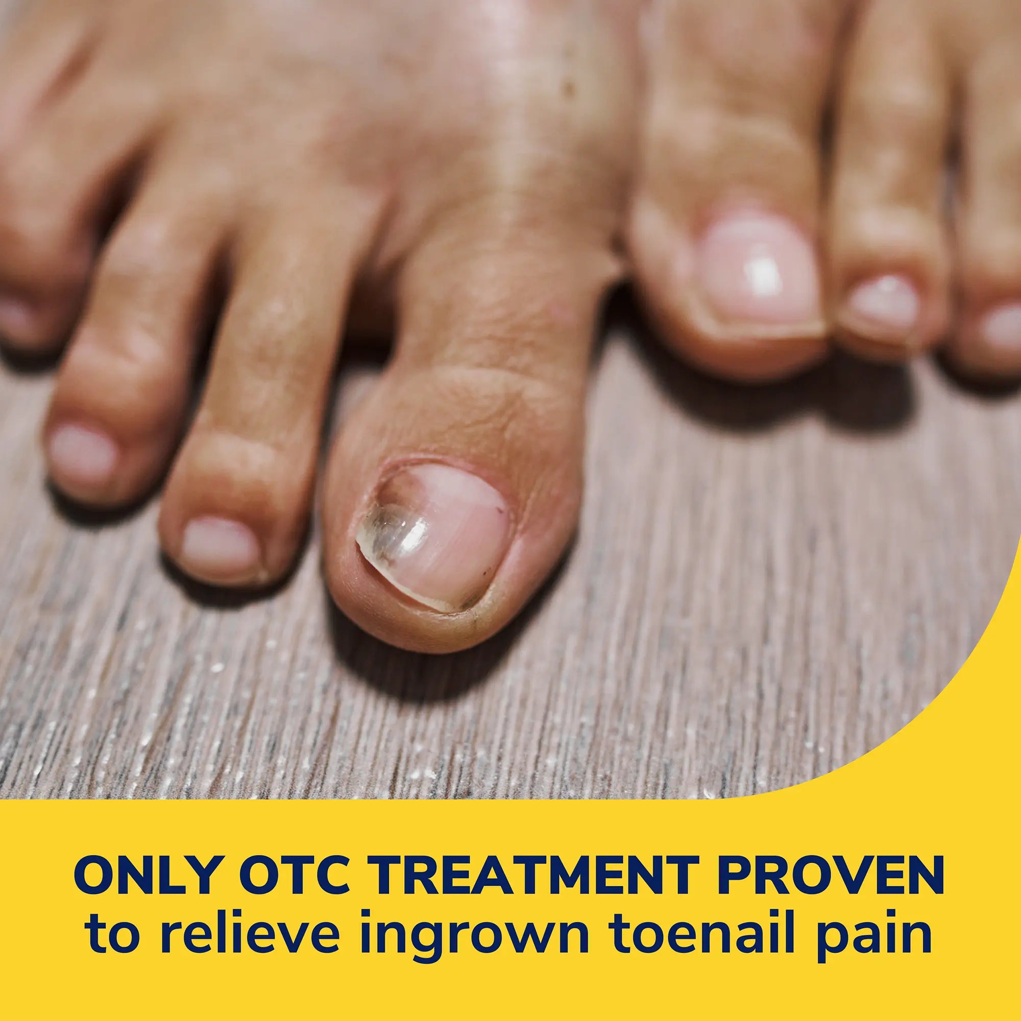 Ingrown Toenail Pain Reliever - Image 3